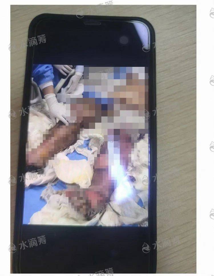 成都一小区6楼租户“飞线充电”，遭遇强降雨造成短路酿火灾，一家四口1死2伤