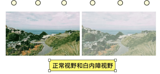 44岁货运司机在太原爱尔“一站式摘掉”近视与白内障， 术后送上单字锦旗：“赞”！