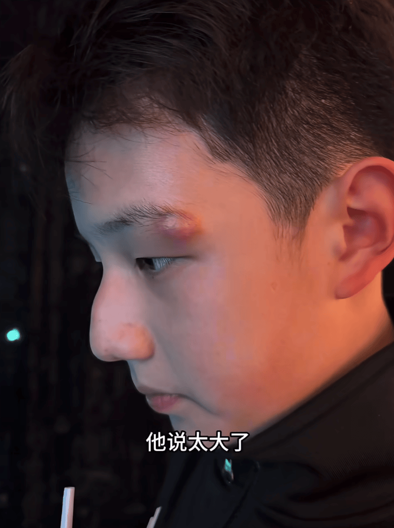 知名女演员深夜向儿子道歉：我一失手，他缝了四针！医生提醒网友→